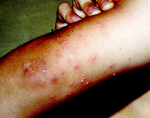 云浮口岸截獲巴基斯坦進(jìn)口淺青玉荒料中的熱帶火蟻